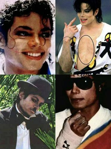 迈克尔杰克逊为什么变白，迈克尔·杰克逊是怎么变白的,本文共（6564字）
