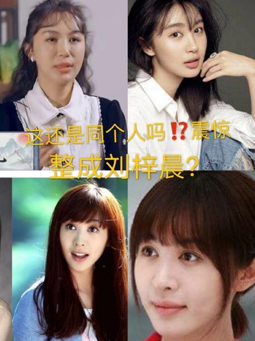 李菲儿整容前后，李菲儿不漂亮(李菲儿没整容之前)