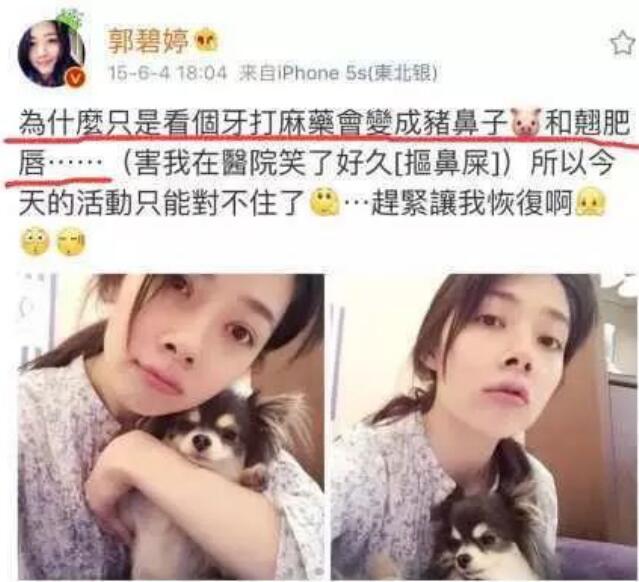 郭碧婷嘴巴歪的吗(郭碧婷脸歪)