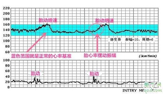 孕晚期每周都要做胎心监护吗(孕晚期是不是每周都要做胎心监护)