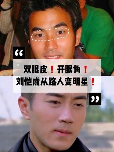 刘恺威整容前后，刘恺威五官(刘恺威整容前后照片对比)